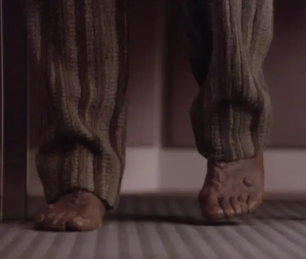 Worf's feet from "Ethics". They have a ridge running up the foot from his second toe, and a large protuberance over the outside of the foot.