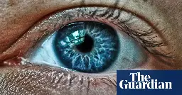 Eye-tattooing: experts warn about risks of colour-changing surgery